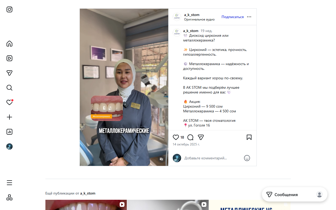 Протезирование — коронки и виниры