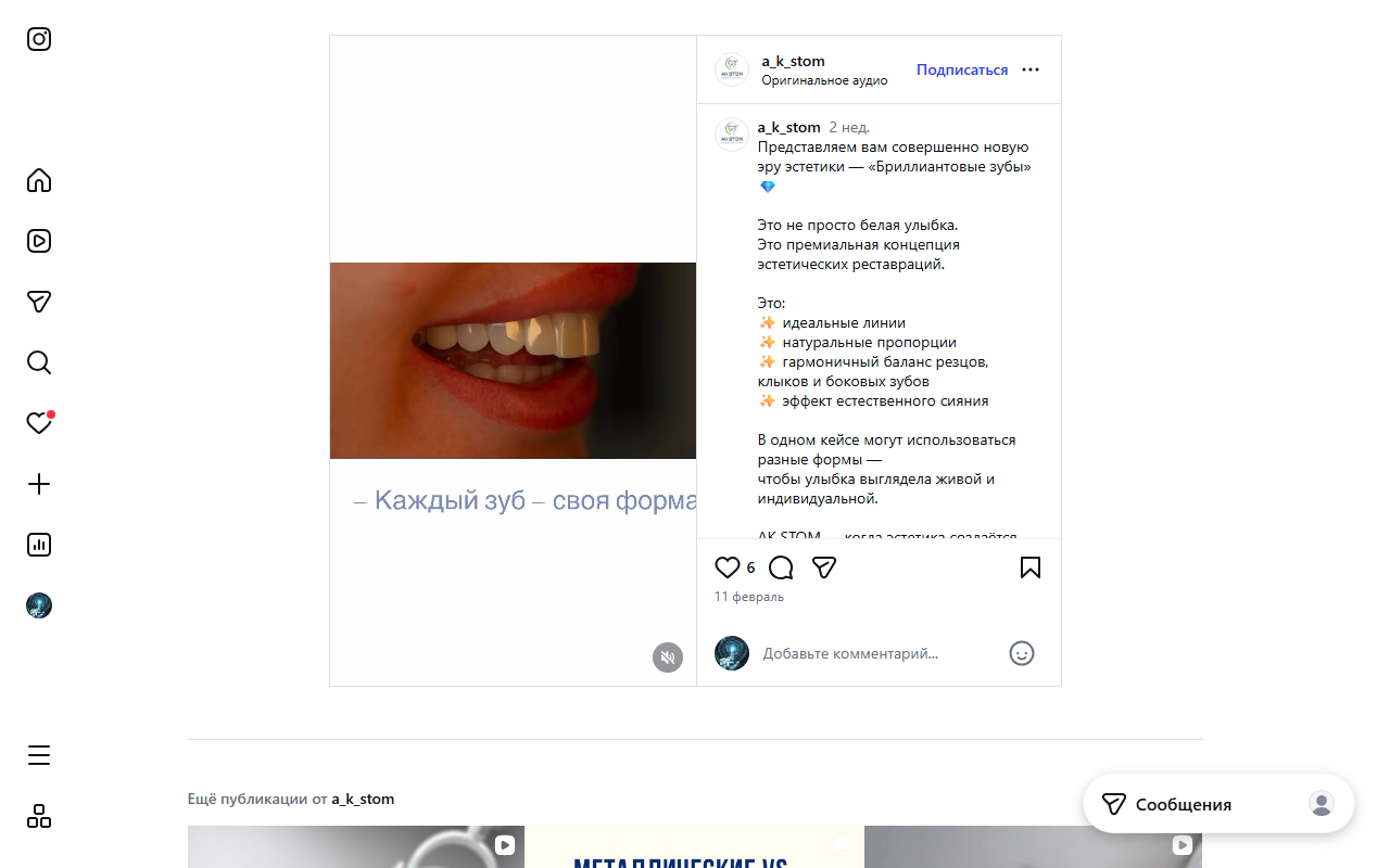 Идеальная улыбка — AK STOM