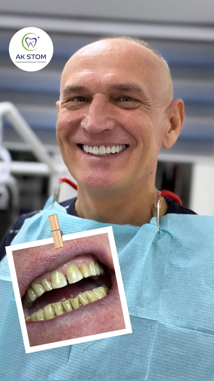 Протезирование