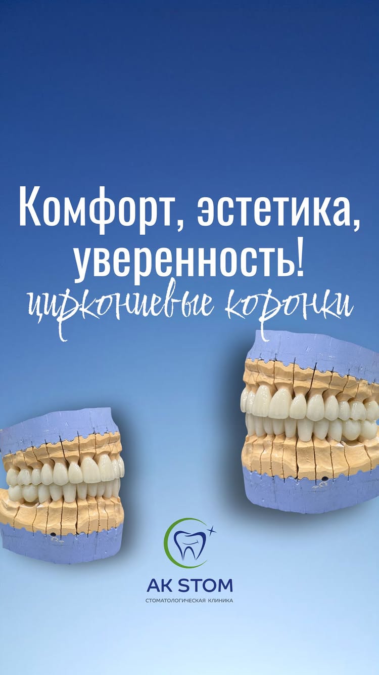 Брекет-система